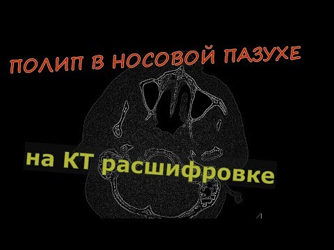 Videó: A Foglalkozási Balesetek és A Biztonsági és Egészségügyi Információk Szolgáltatása Közötti Kapcsolat: A 4. Koreai Munkakörülményekről Szóló Felmérés Adatai