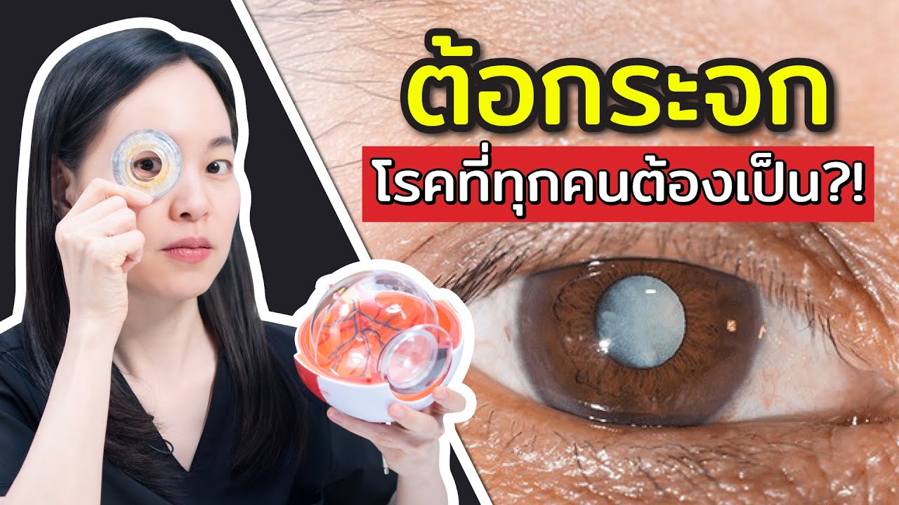 ต้อกระจก โรคที่ทุกคนต้องเป็น?!