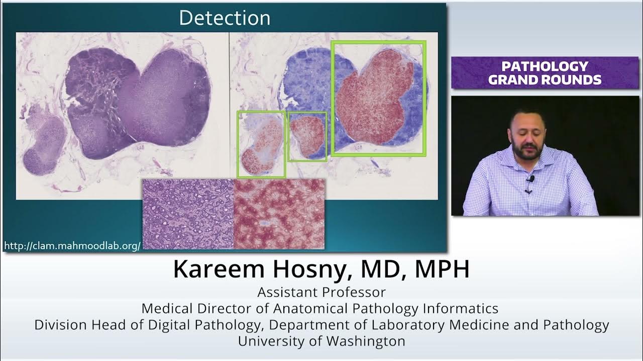 AI and Anatomical Pathology, is it a threat?  A glance at the Present of Pathology