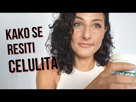 Video: 5 načina za sprječavanje strija