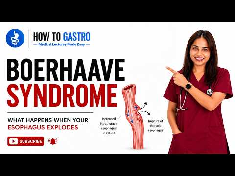 Boerhaave Syndrome: Your Esophagus Can Explode From Vomiting - Here's Why — video thumbnail