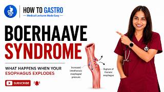 Boerhaave Syndrome: Your Esophagus Can Explode From Vomiting - Here's Why