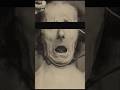 He was Alive 💀 | Horrific History| #shorts #ytshorts #creepy #creepypasta