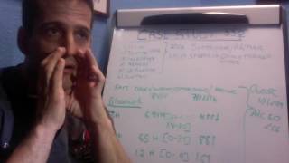 Hashimoto Hypothyroid Case Study in Boca Raton