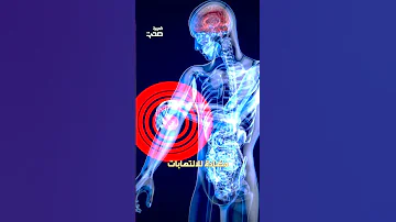فوائد المورينجا النبتة المعجزة 