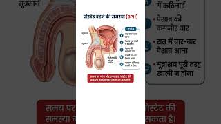 prostate #prostatehealth #shorts #pleasesubscribe #ytshorts