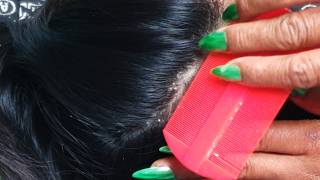 ASMR Slow & Gentle Scalp Check 💖 Long Hair Soothing Experience C0033