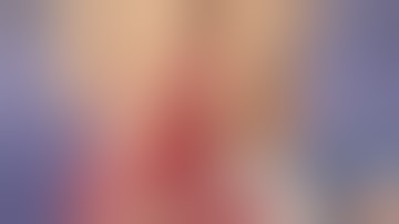 Appendectomy - Dr. Tamer Ashraf