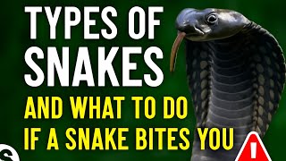 Types of Snakes 🐍 & What To Do If a Snake Bites You | Snake Bite First Aid Explained”