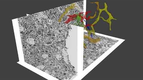 Segmentation and 3D reconstruction of FIB-SEM datasets