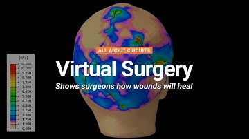 Virtual Surgery