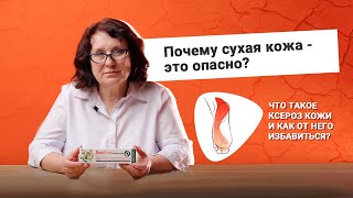 Почему сухая кожа  - это опасно?  Что такое ксероз кожи и как от него избавиться?