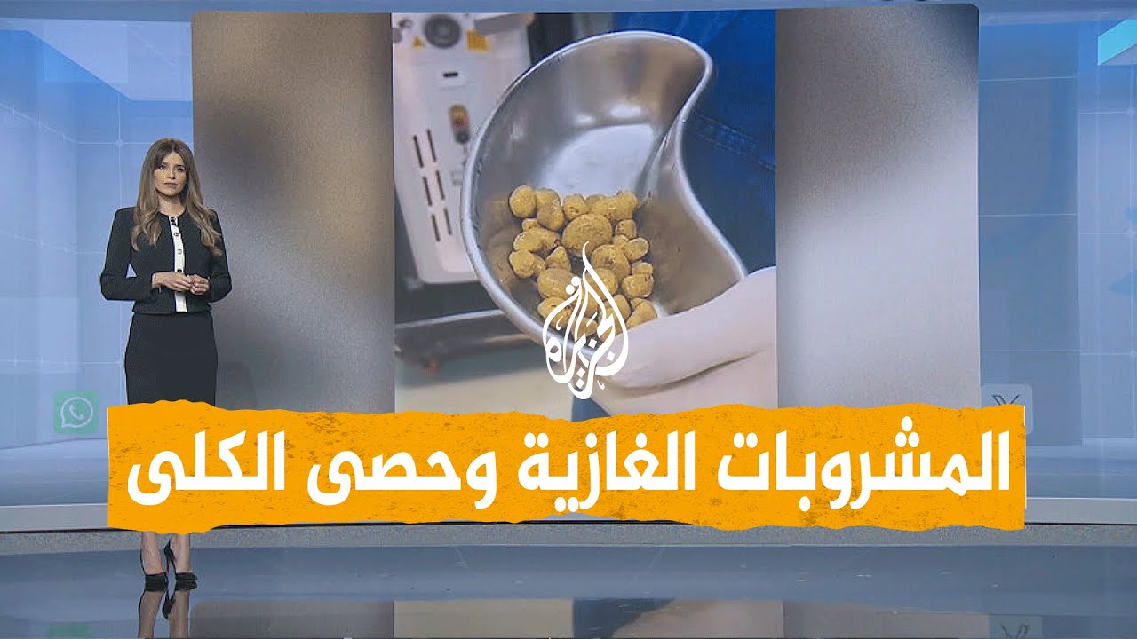 شبكات | استخراج 30 حصوة من كلية مريض بسبب المشروبات الغازية