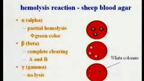 2.20. Streptococci - Medical Microbiology