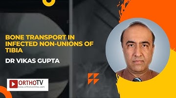 Bone Transport in Infected non unions of Tibia   Dr Vikas gupta
