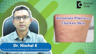 How to get rid of KERATOSIS PILARIS or CHICKEN SKIN #expertskisuno -Dr. Nischal K| Doctors' Circle