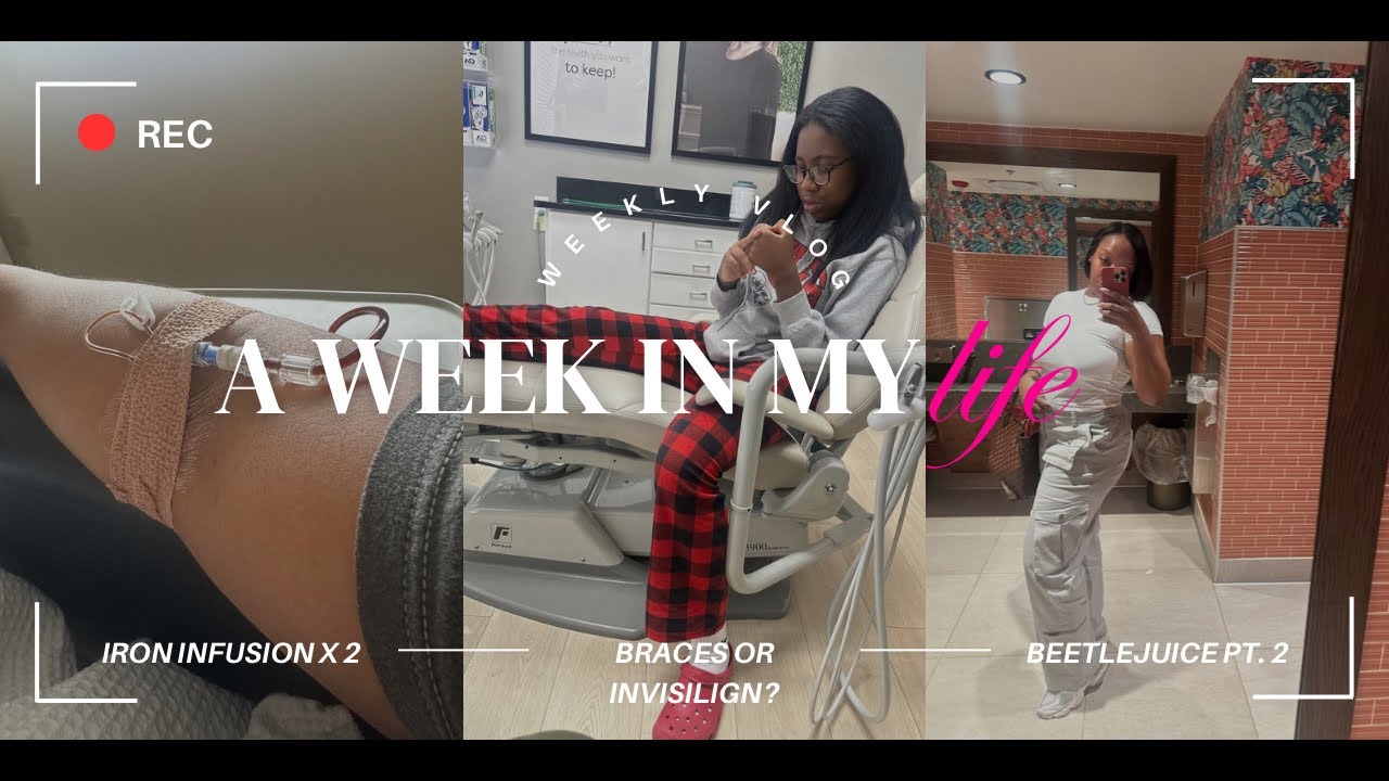 WEEKLY VLOG| ANOTHER IRON INFUSION?! BEETLEJUICE 2| BRACES OR ...