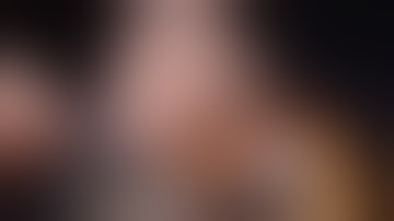 CarbonAid & CarbonMini CO2 Diffusers De-Airing Techniques in Open Heart Surgery