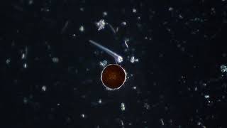 Arcella sp. (Testate amoeba) - Protozoans and other small critters