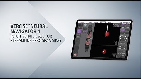 Streamline the DBS workflow with Stimview™ XT technology