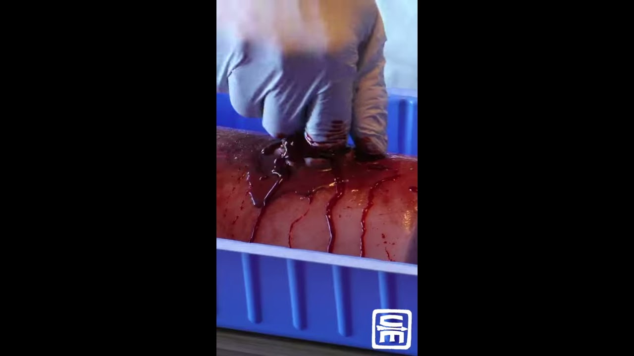Wound Packing Tip 2