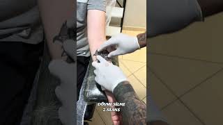 2.SEANS DÖVME SİLME
