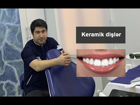 Video: Keramika nədir? Semikarakorsk keramika