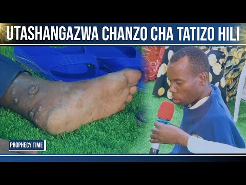 UNABII UTASHANGAZWA NA CHANZO KIKUBWA CHA TATIZO LA BABA HUYU 