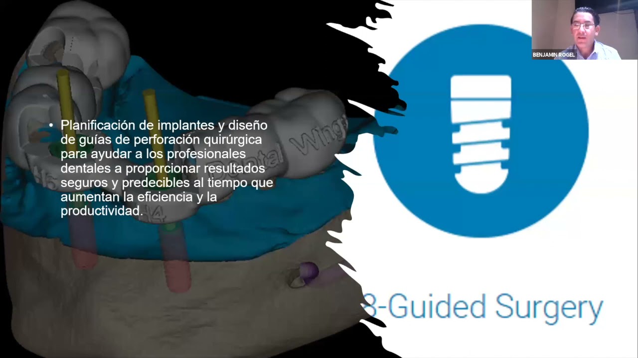 Straumann Day Digital Solutions: coDiagnostix® con el C.D. Benjamín Mancilla