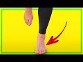 If You Have a Metatarsal Stress Fracture... WATCH THIS