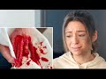 I CUT MY FINGER OFF!!! *PRANK*