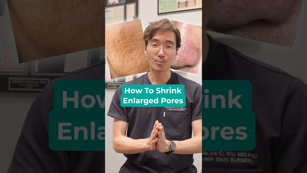Banner for Enlarged pores can be caused by a variety of factors! #laser