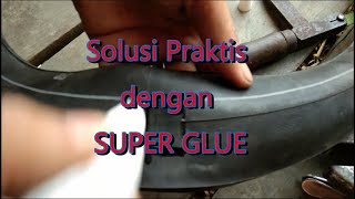 Cara Melepaskan Kulit Jari Kena ALTECO Lem G Super Glue