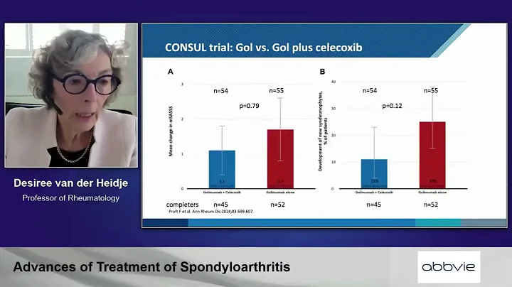 RNL 25 Replay: Spondyloarthritis