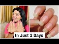 How to grow your nails in 2 days | Long & Strong Nails |