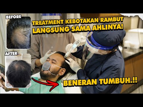 Video: 3 Cara Rambut Tipis