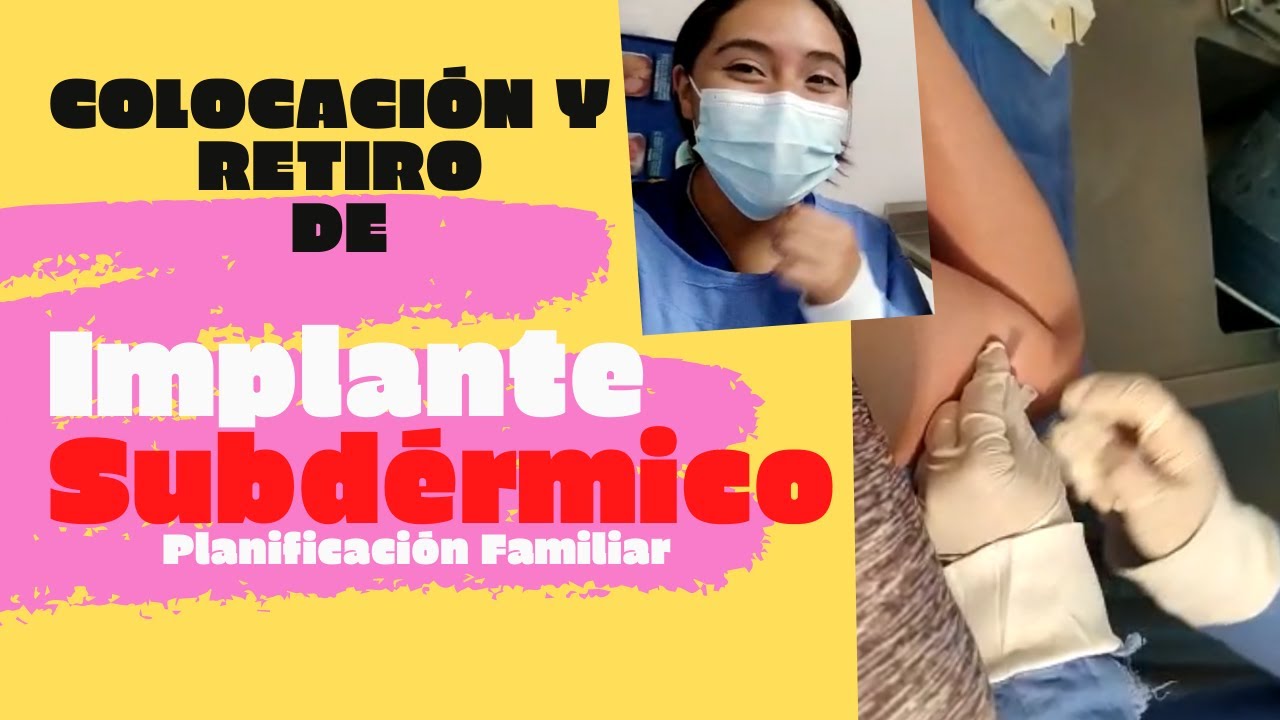 IMPLANTE HORMONAL SUBDÉRMICO| COLOCACIÓN Y RETIRO| PLANIFICACIÓN