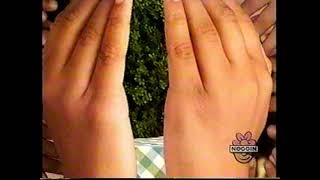 Noggin Break  August 24th 2001 incomplete