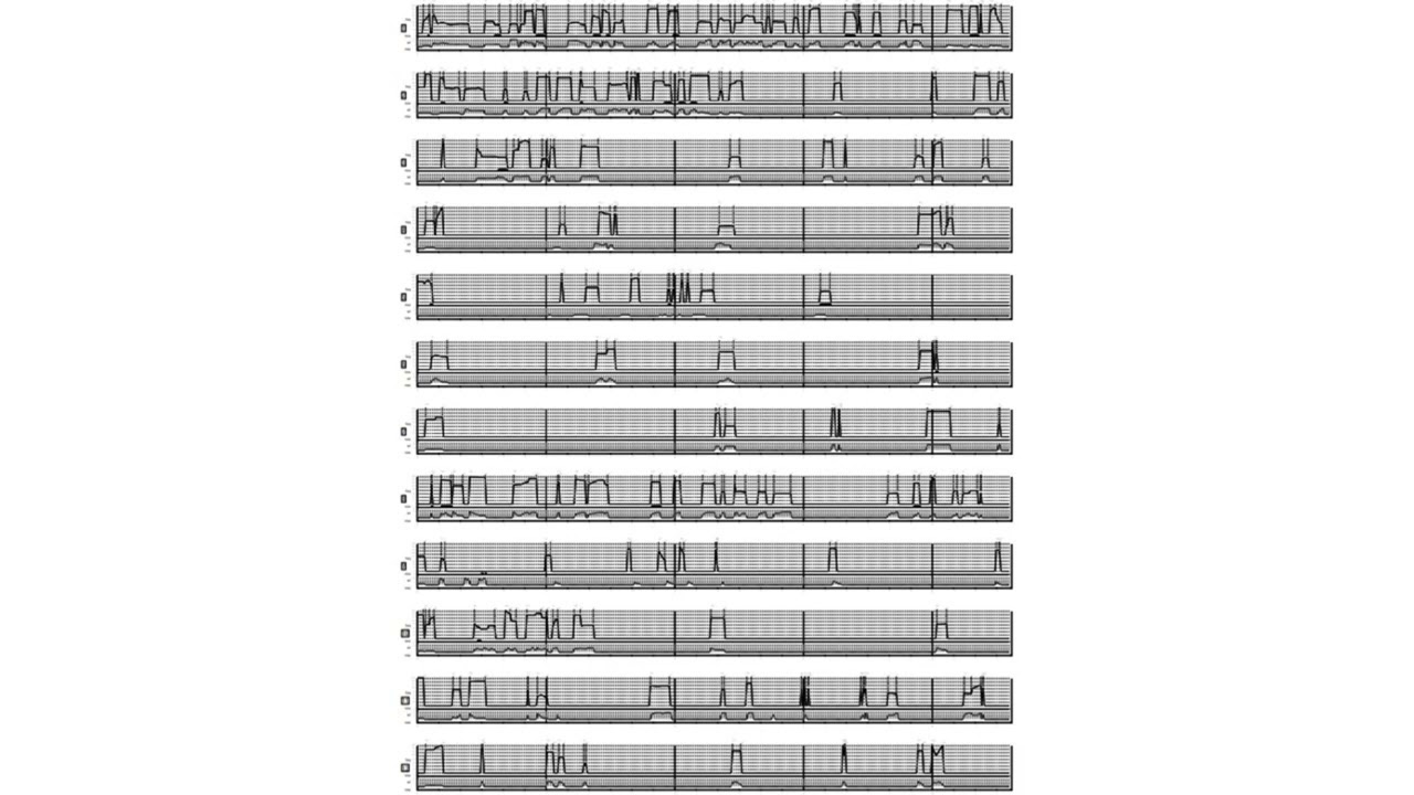 John Cage: Imaginary Landscape No.4 (Valle & Casella score - version for 12 samples from 1951)
