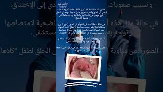 حذاري من لسعات النحل في الحلق #الجزائر #طبيبك_في_بيتك #طالبةطب #طب #طالب_طب