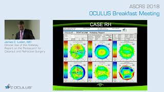 James C. Loden, MD: Clinical Use of the Holladay Report on the Pentacam® for Surgery