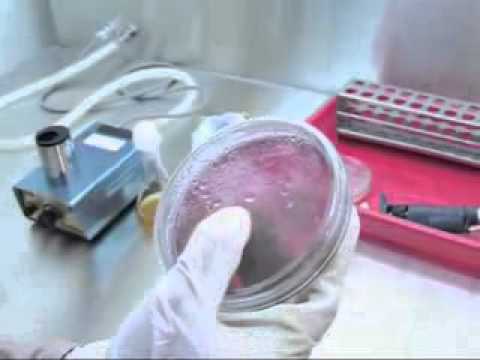 Mikroba untuk Pencegahan Kanker
