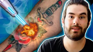 Why Im removing my tattoos | My experience with laser tattoo removal
