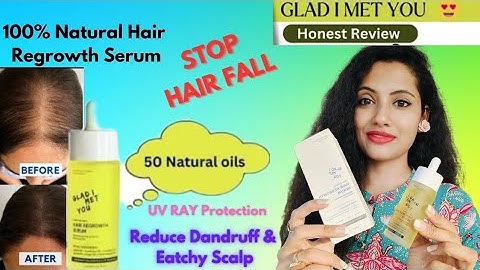 Just natural bald spot treatment reviews năm 2024