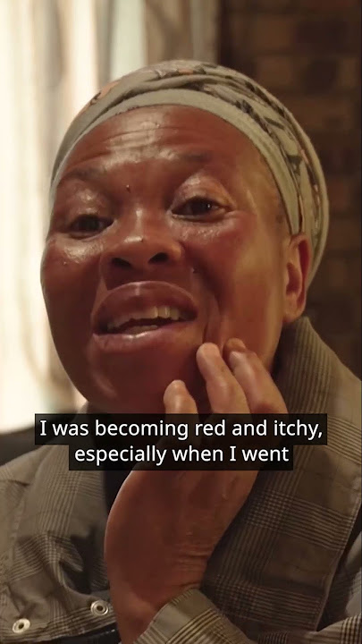 This is what skin bleaching products do to your skin over time #skincare #healthcare  #the77percent