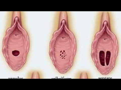 Vidéo: Comment Perdre Votre Virginité Sans Douleur: 26 Conseils, Techniques Et Plus