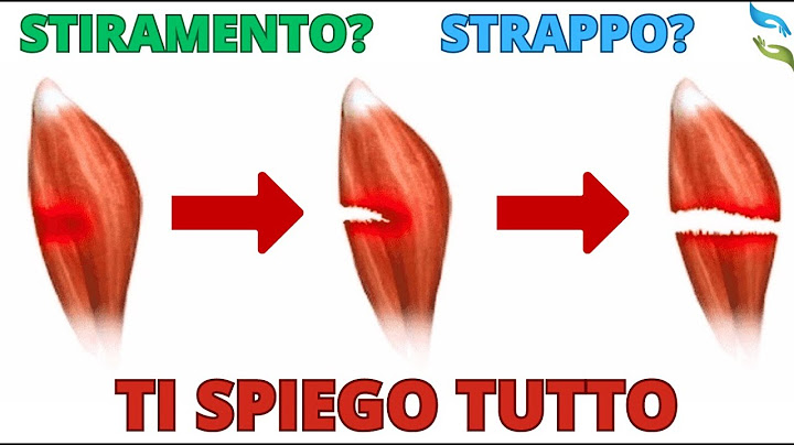 Ti spiego lo STIRAMENTO e lo STRAPPO muscolare
