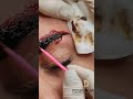 ریموو و پاک کردن تتوهای قدیمی در میکرو آکاددمی توسط تکنسین ریموو مریم بخشی با مواد آلمانی ریمووتتو ریموو و پاک کردن تتوهای قدیمی در میکرو آکاددمی توسط تکنسین ریموو مریم بخشی با مواد آلمانی ریمووتتو
