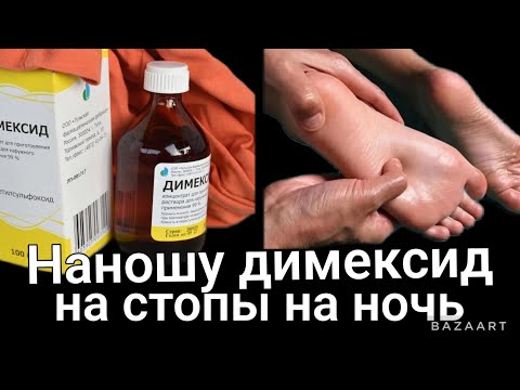 Компресс с Димексидом на стопы лечит даже...