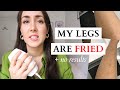 At Home Laser Hair Removal BURNED my LEGS | Before and After | Kenzii Review